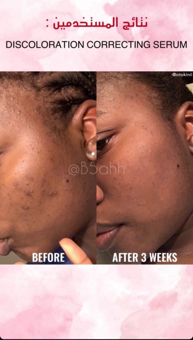 Good molecules, Discoloration Correcting Serum